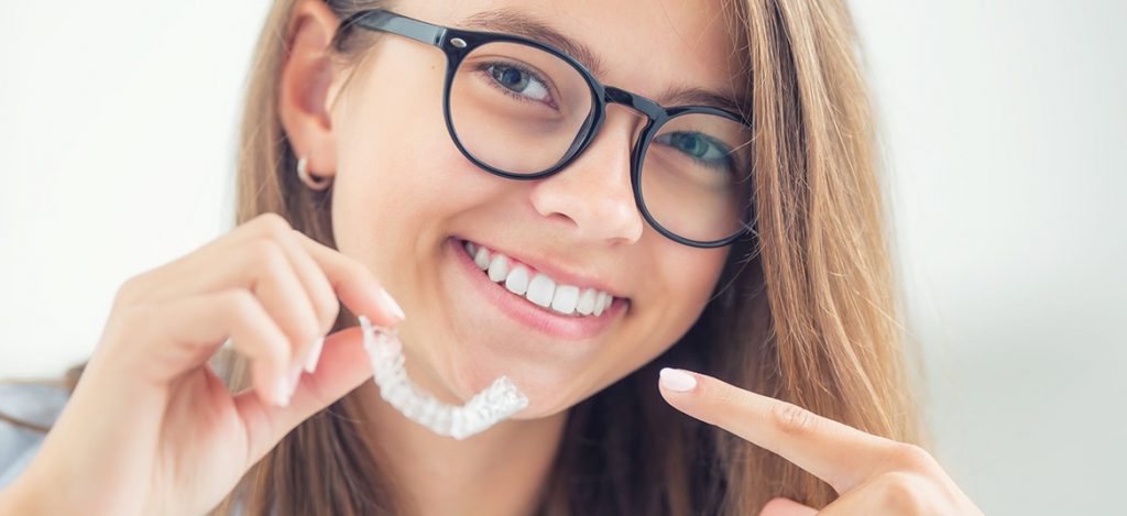 aparelho Invisalign