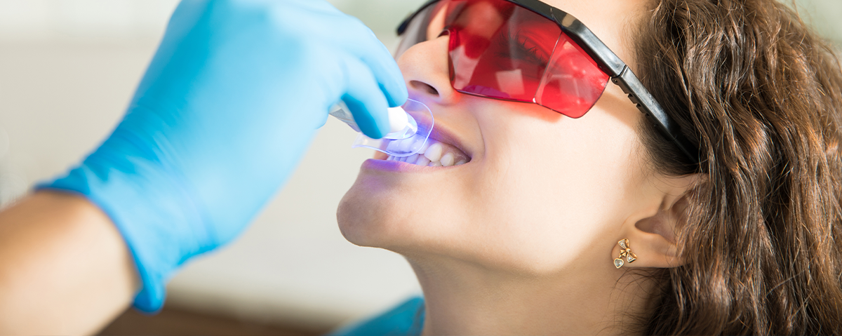 clareamento dental
