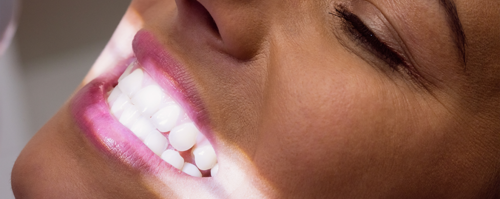 clareamento dental